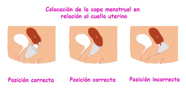 colocacion copa menstrual